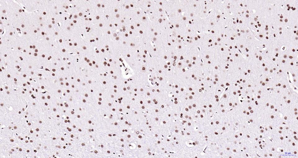 乙酰化组蛋白H3重组兔单抗-bsm-62460R
