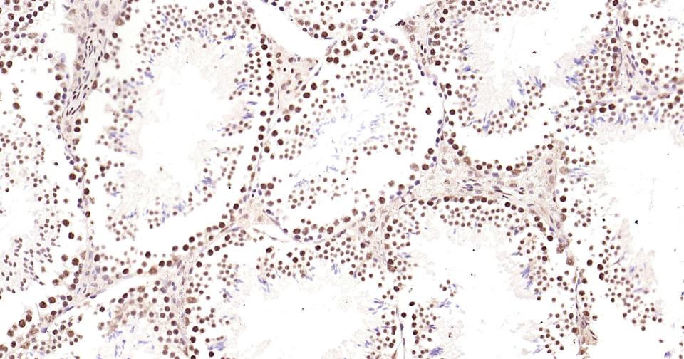 磷酸化CREB-1重组兔单抗-bsm-61105R