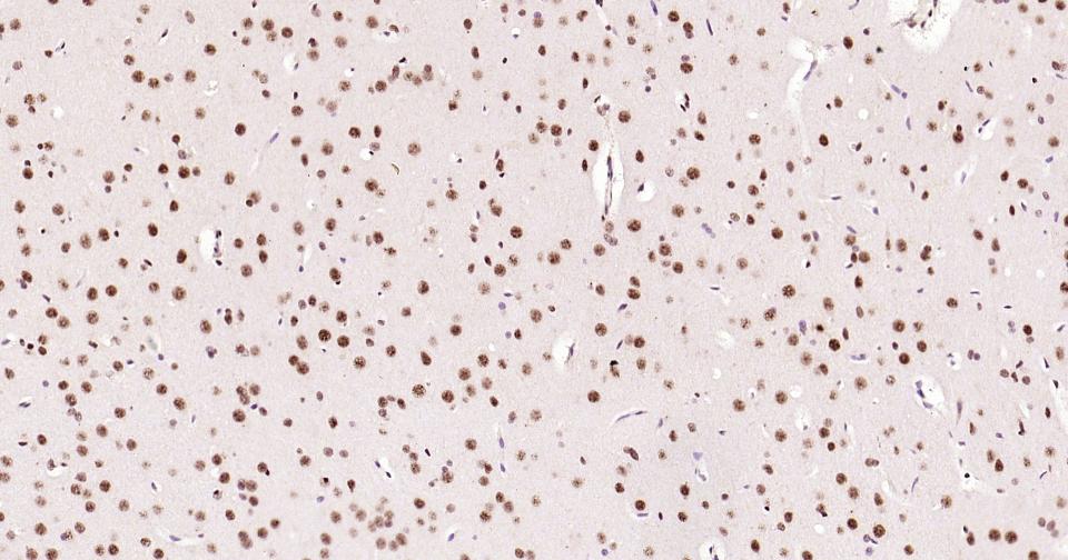 磷酸化CREB-1重组兔单抗-bsm-61105R