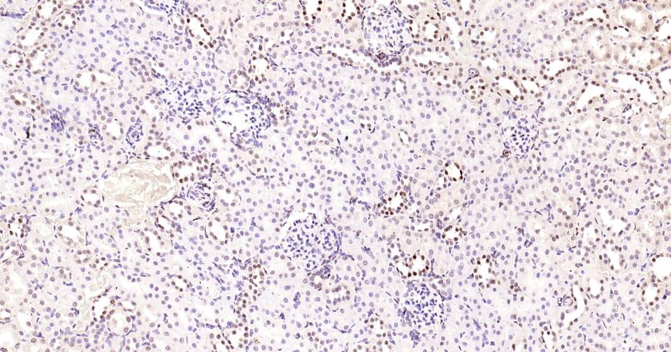 磷酸化CREB-1重组兔单抗-bsm-61105R
