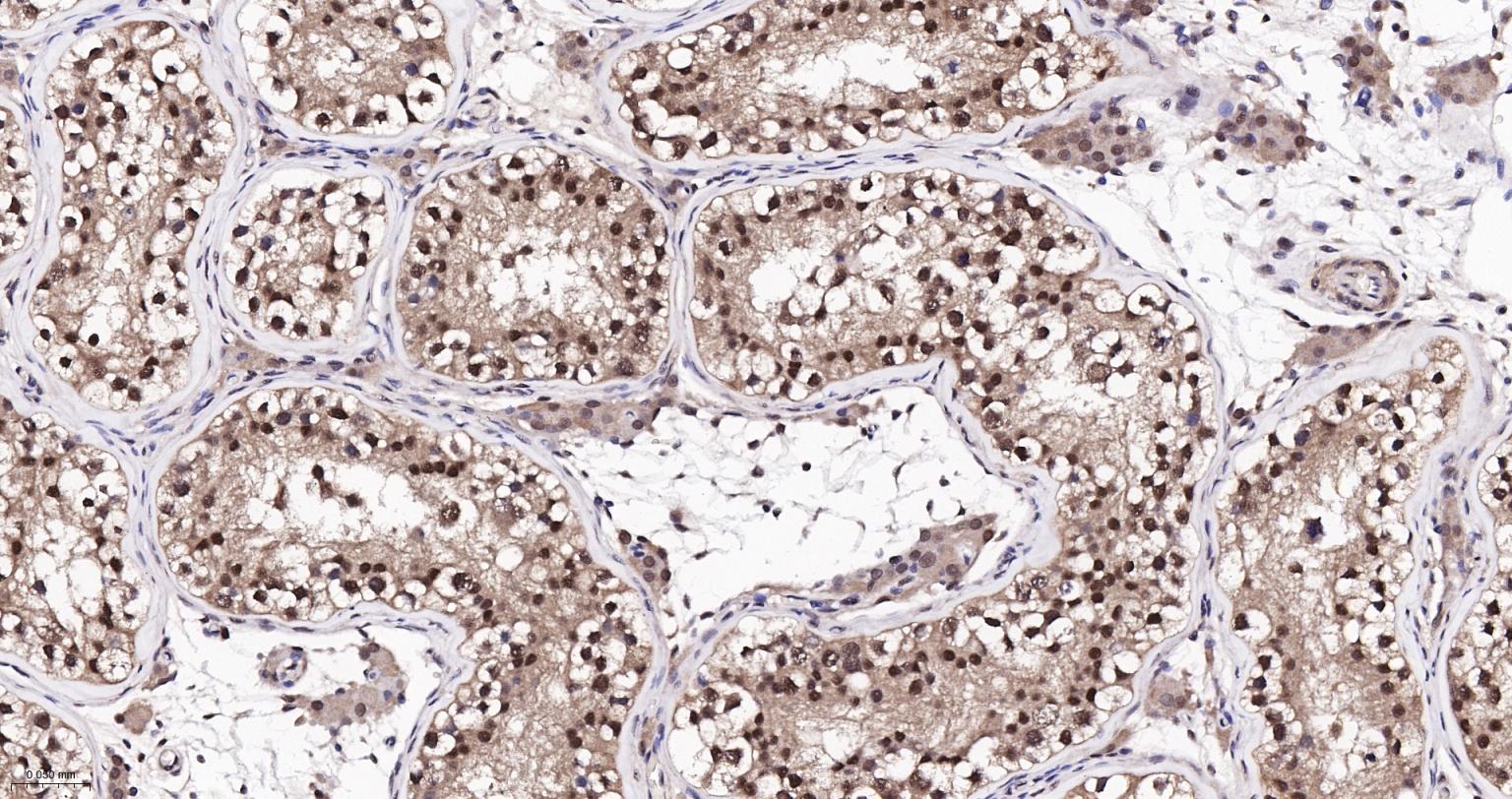 泛素蛋白（K48-linkage）重组兔单抗-bsm-63005R