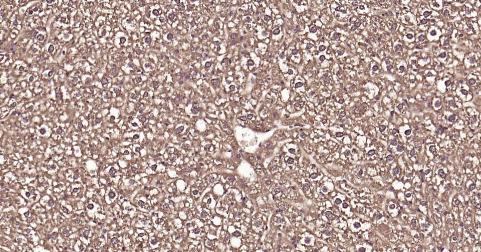 泛素蛋白（K63-linkage）重组兔单抗-bsm-63006R