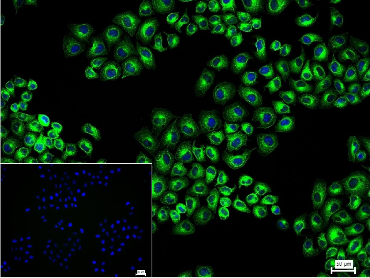 微管蛋白β tubulin/Tubulin β（内参）重组兔单抗-bsm-33034R