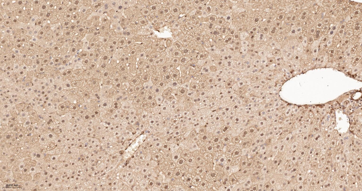 泛素蛋白重组兔单抗-bsm-63008R