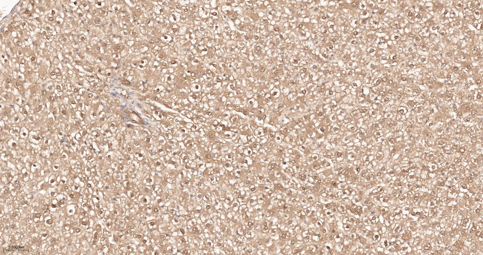 泛素蛋白重组兔单抗-bsm-63008R