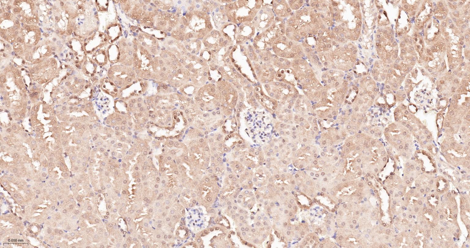 泛素蛋白重组兔单抗-bsm-63008R