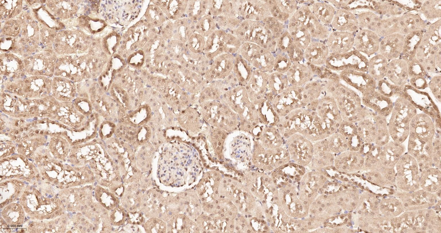 泛素蛋白重组兔单抗-bsm-63008R