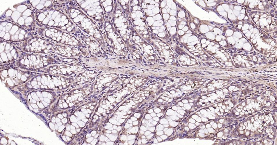 微管蛋白α/Tubulin α（内参）抗体-bs-0159R