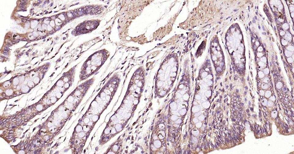 微管蛋白α/Tubulin α（内参）抗体-bs-0159R