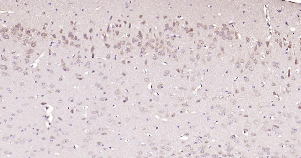 微管蛋白α/Tubulin α（内参）抗体-bs-0159R