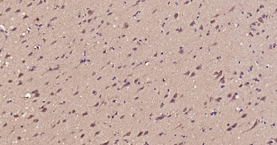 微管蛋白α/Tubulin α（内参）抗体-bs-0159R