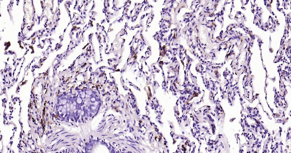 CD163重组兔单抗-bsm-54015R