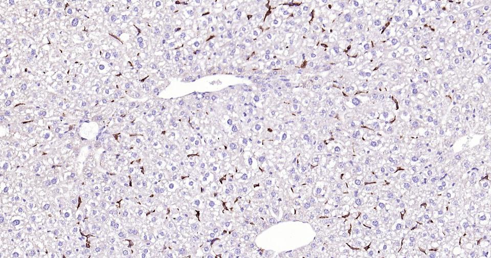 CD163重组兔单抗-bsm-54015R