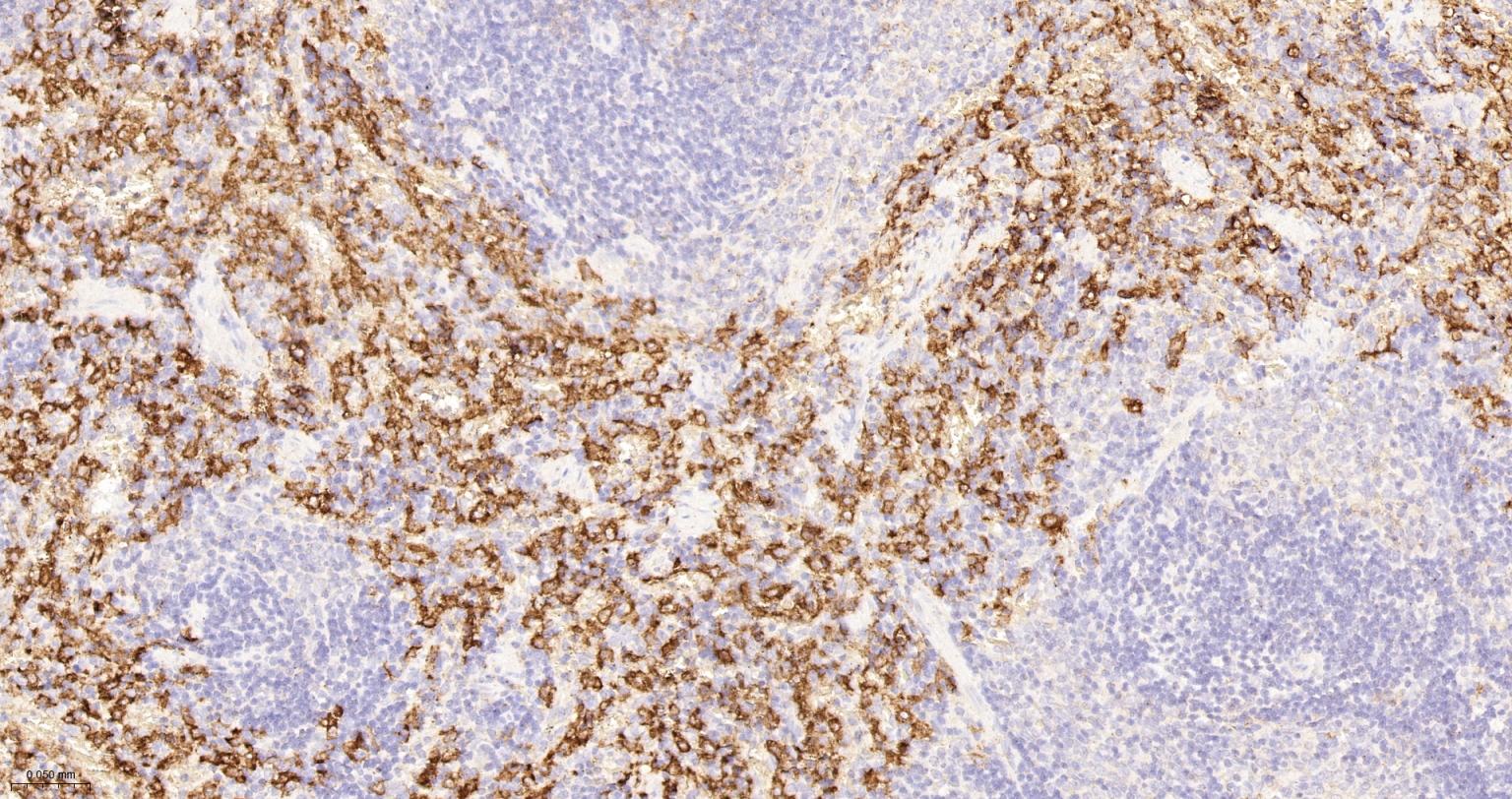 CD163重组兔单抗-bsm-54015R