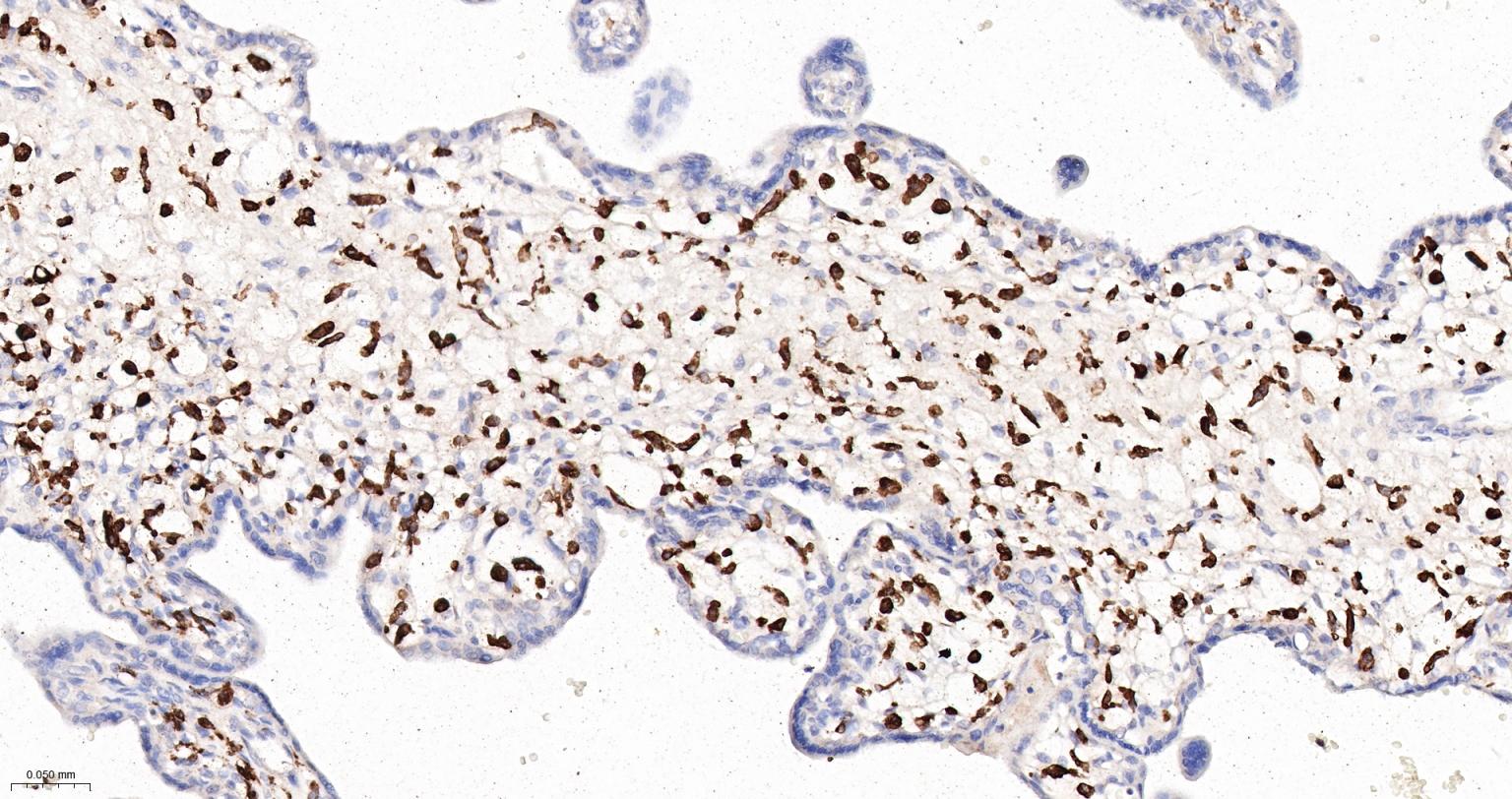CD163重组兔单抗-bsm-54015R
