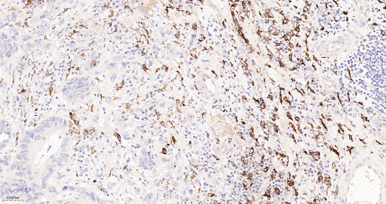 CD163重组兔单抗-bsm-54015R