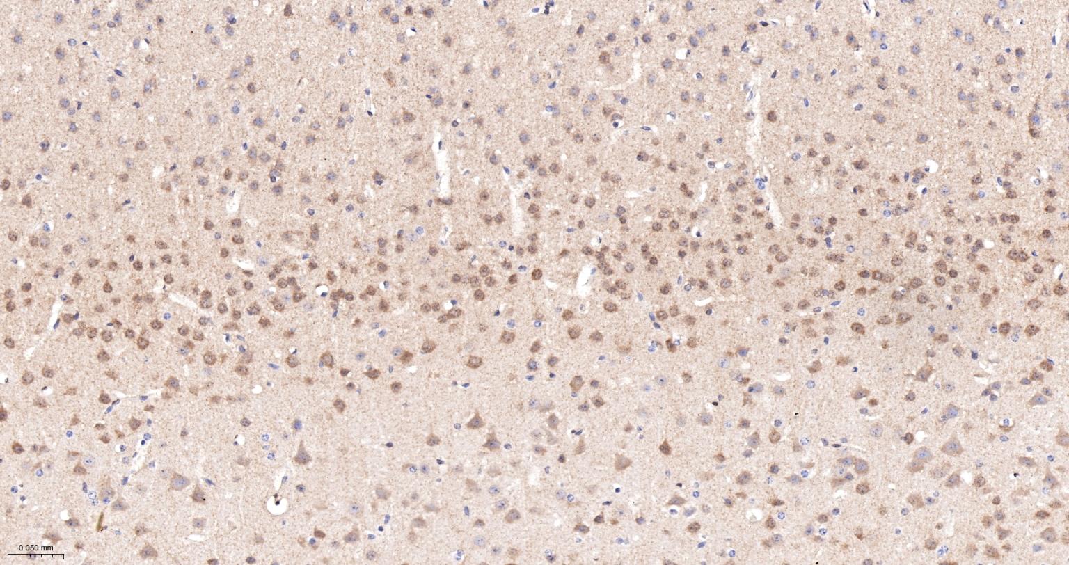 一种肿瘤抑制基因抗体-bsm-52369R