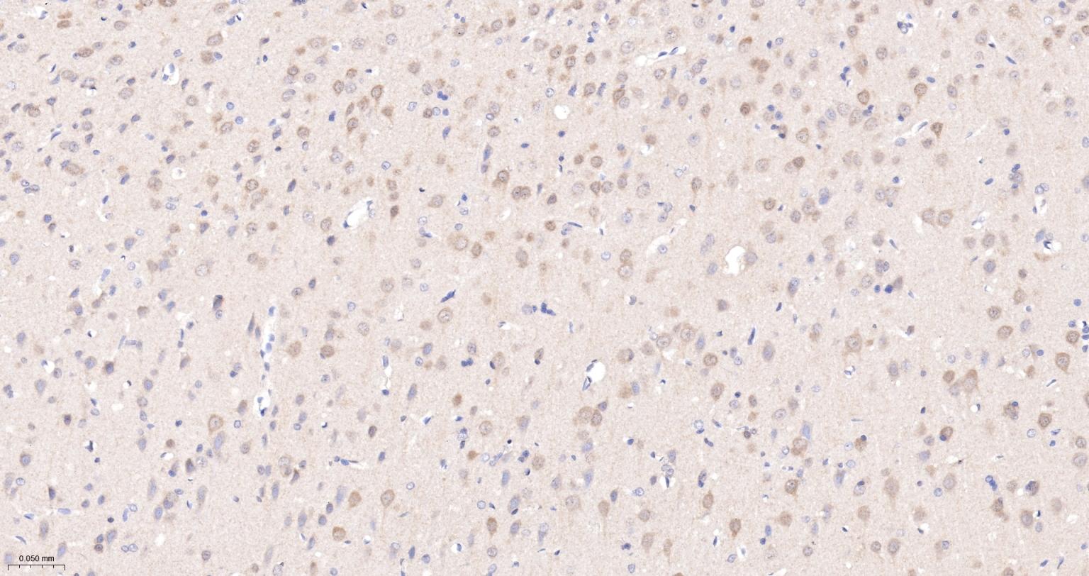 一种肿瘤抑制基因抗体-bsm-52369R
