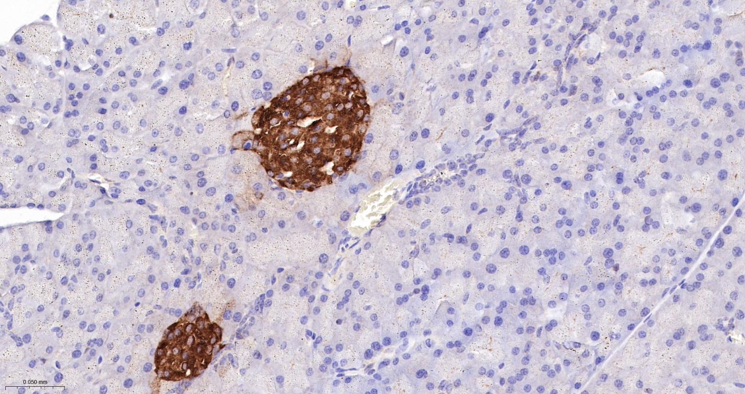 一种肿瘤抑制基因抗体-bsm-52369R