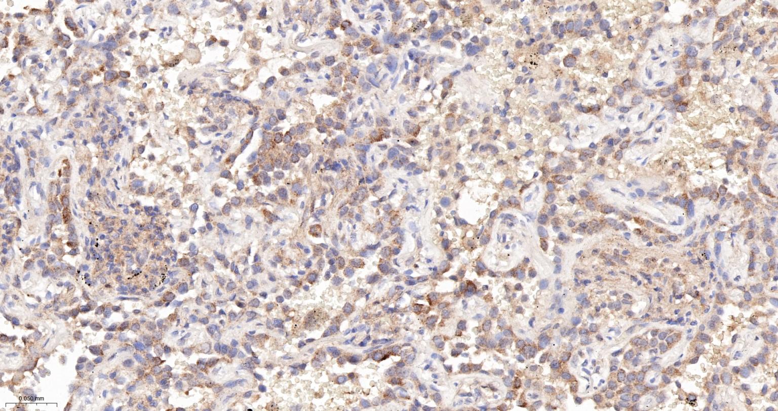 一种肿瘤抑制基因抗体-bsm-52369R