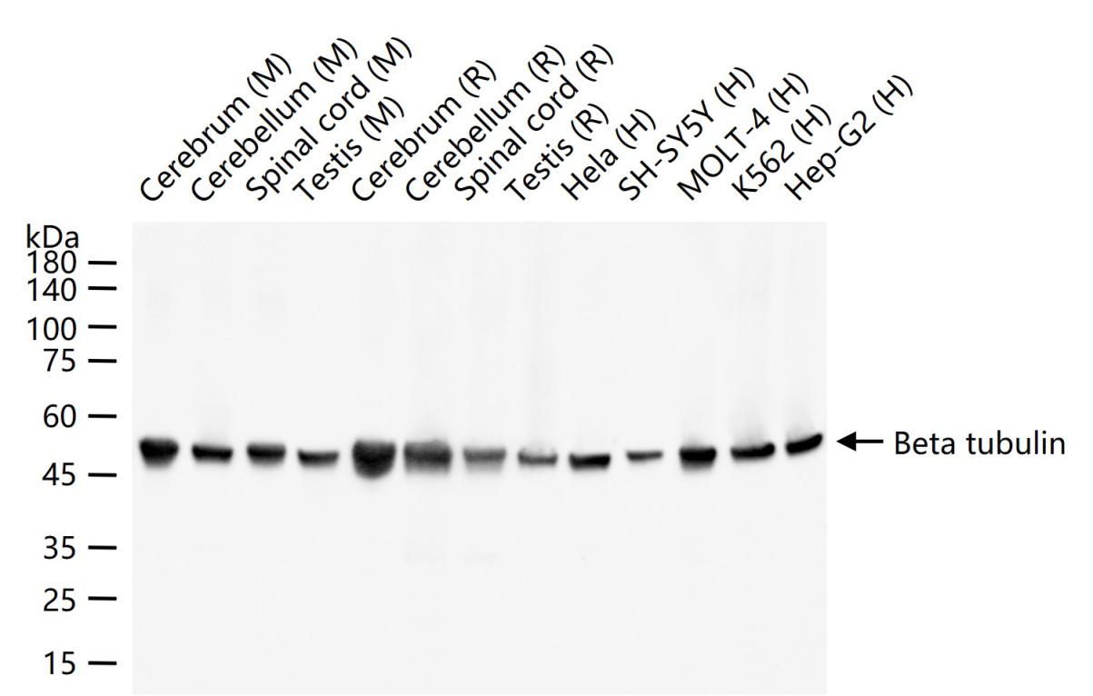 微管蛋白β tubulin/Tubulin β（内参）重组兔单抗-bsm-33034R