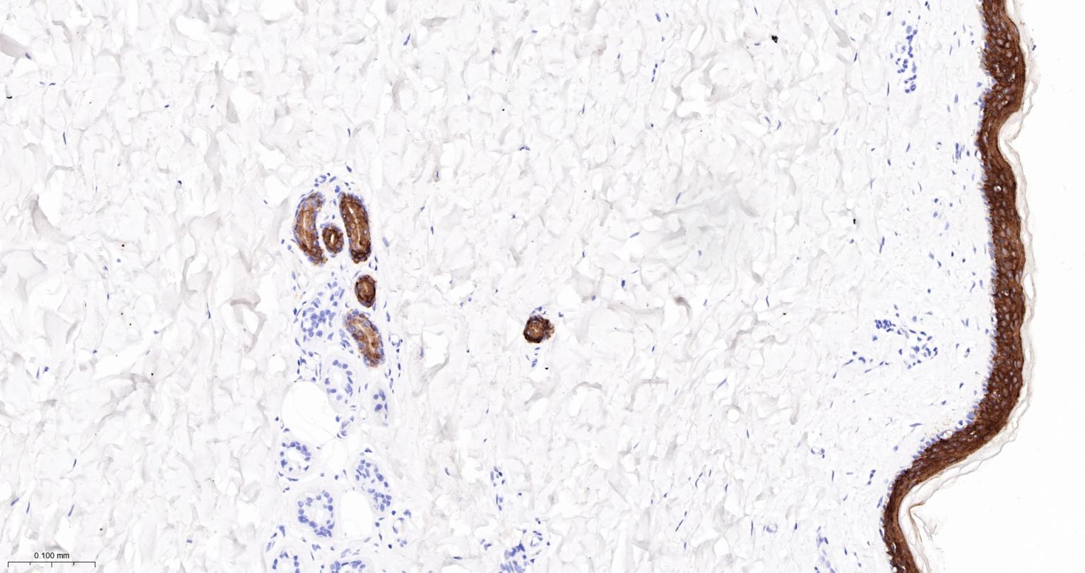 细胞角蛋白10重组兔单抗-bsm-52052R