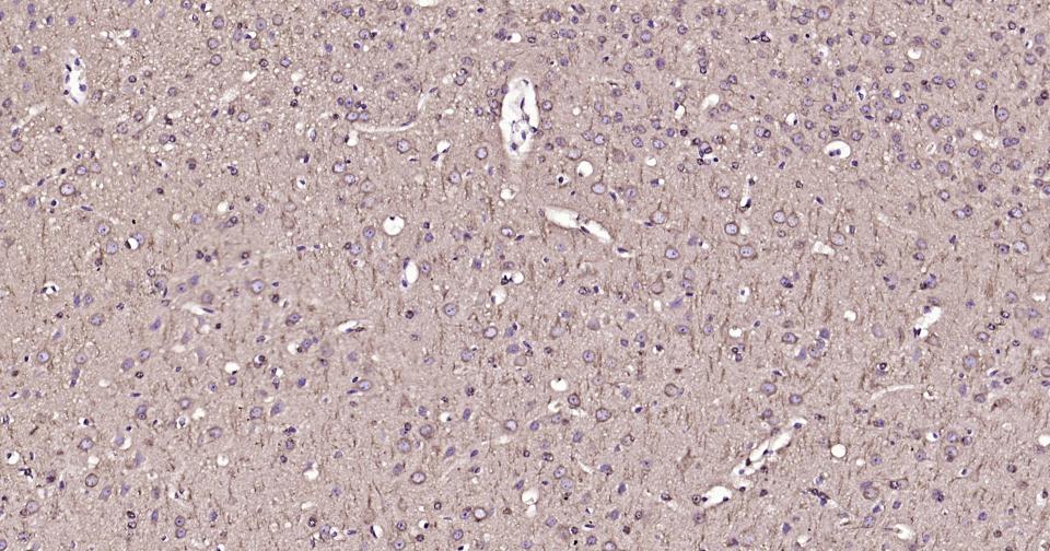 微管蛋白β tubulin(内参)单克隆抗体-bsm-33041M