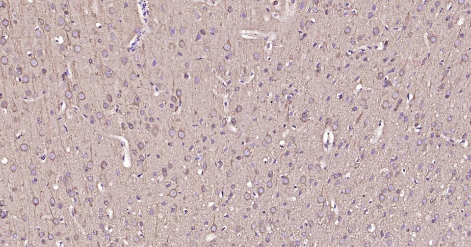 微管蛋白β tubulin(内参)单克隆抗体-bsm-33041M