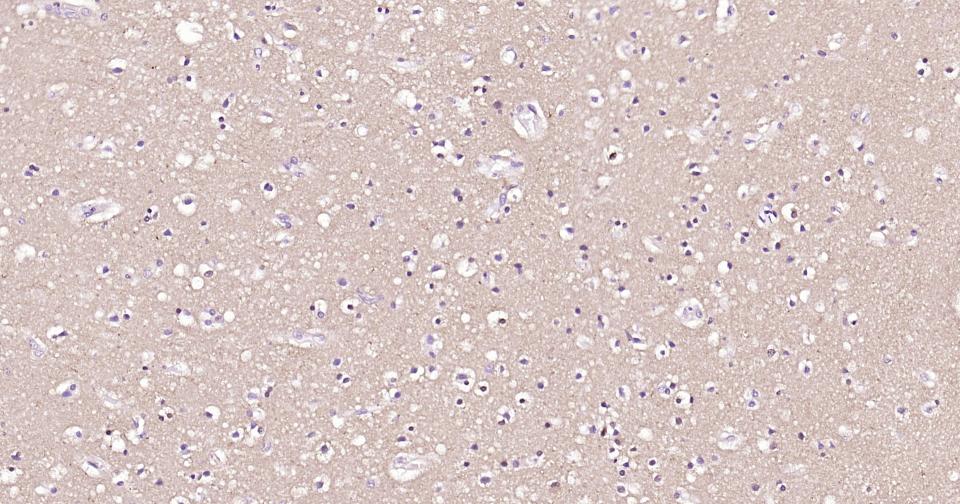 微管蛋白β tubulin(内参)单克隆抗体-bsm-33041M