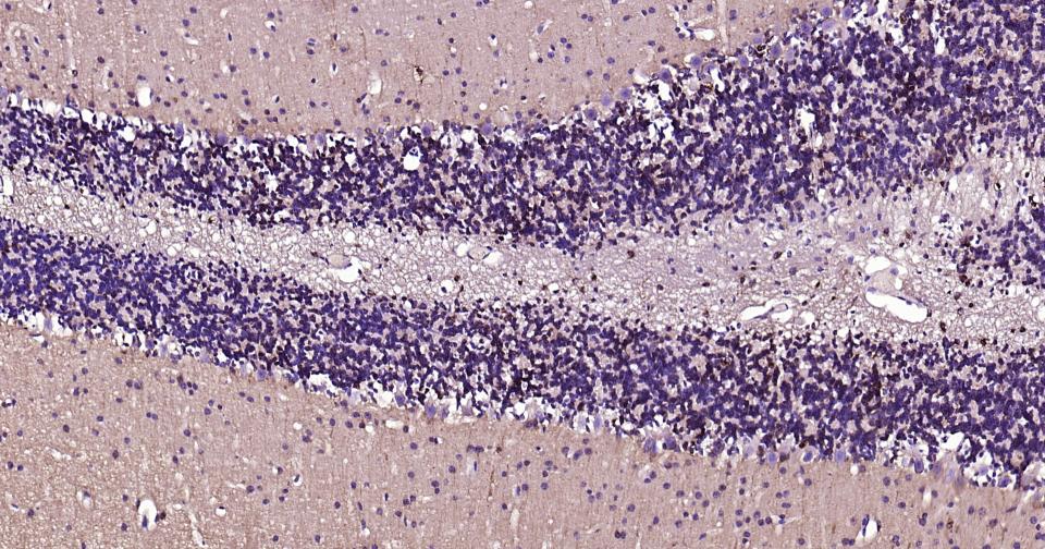 微管蛋白β tubulin(内参)单克隆抗体-bsm-33041M