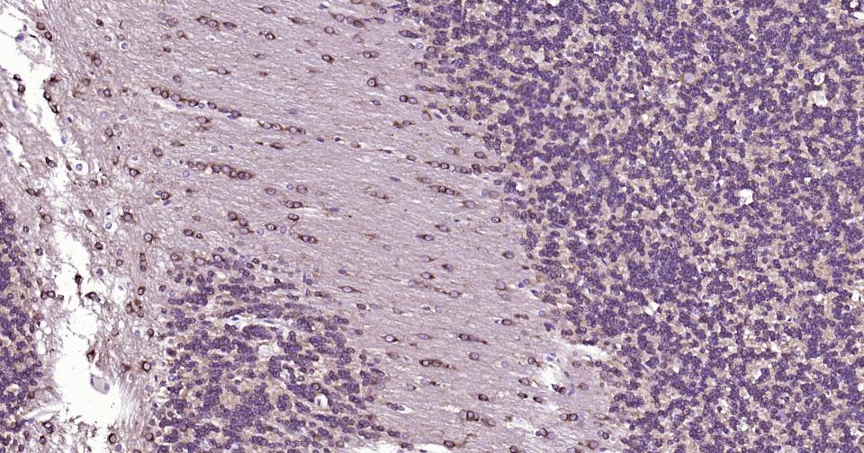 微管蛋白β tubulin(内参)单克隆抗体-bsm-33041M