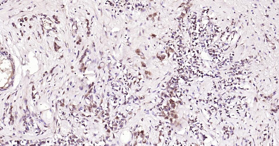 微管蛋白β tubulin(内参)单克隆抗体-bsm-33041M