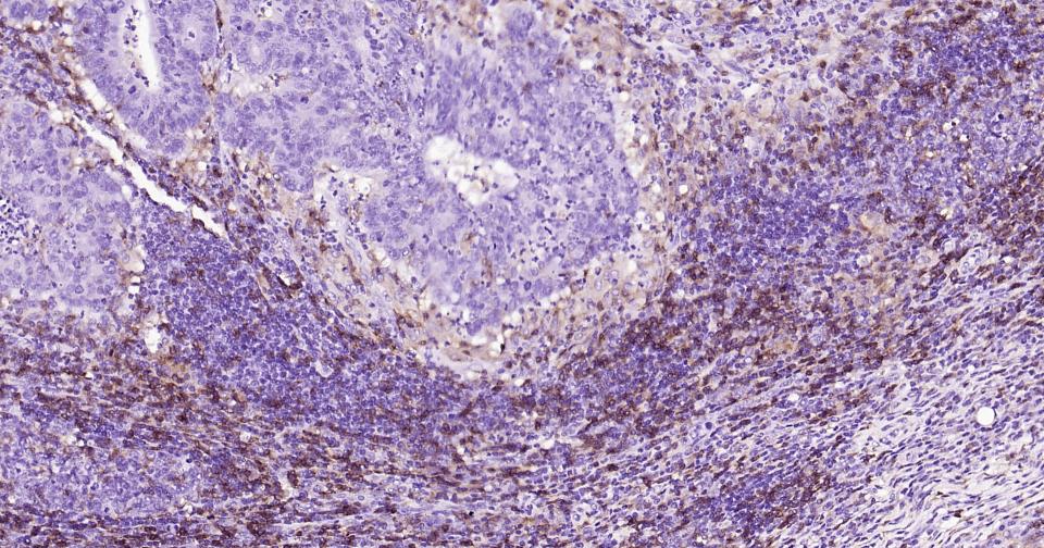 CD4重组兔单抗-bsm-52469R