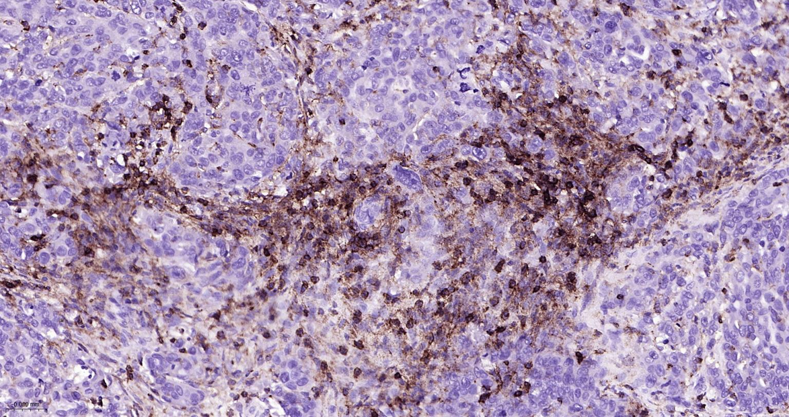 白细胞共同抗原CD45重组兔单抗-bsm-54757R