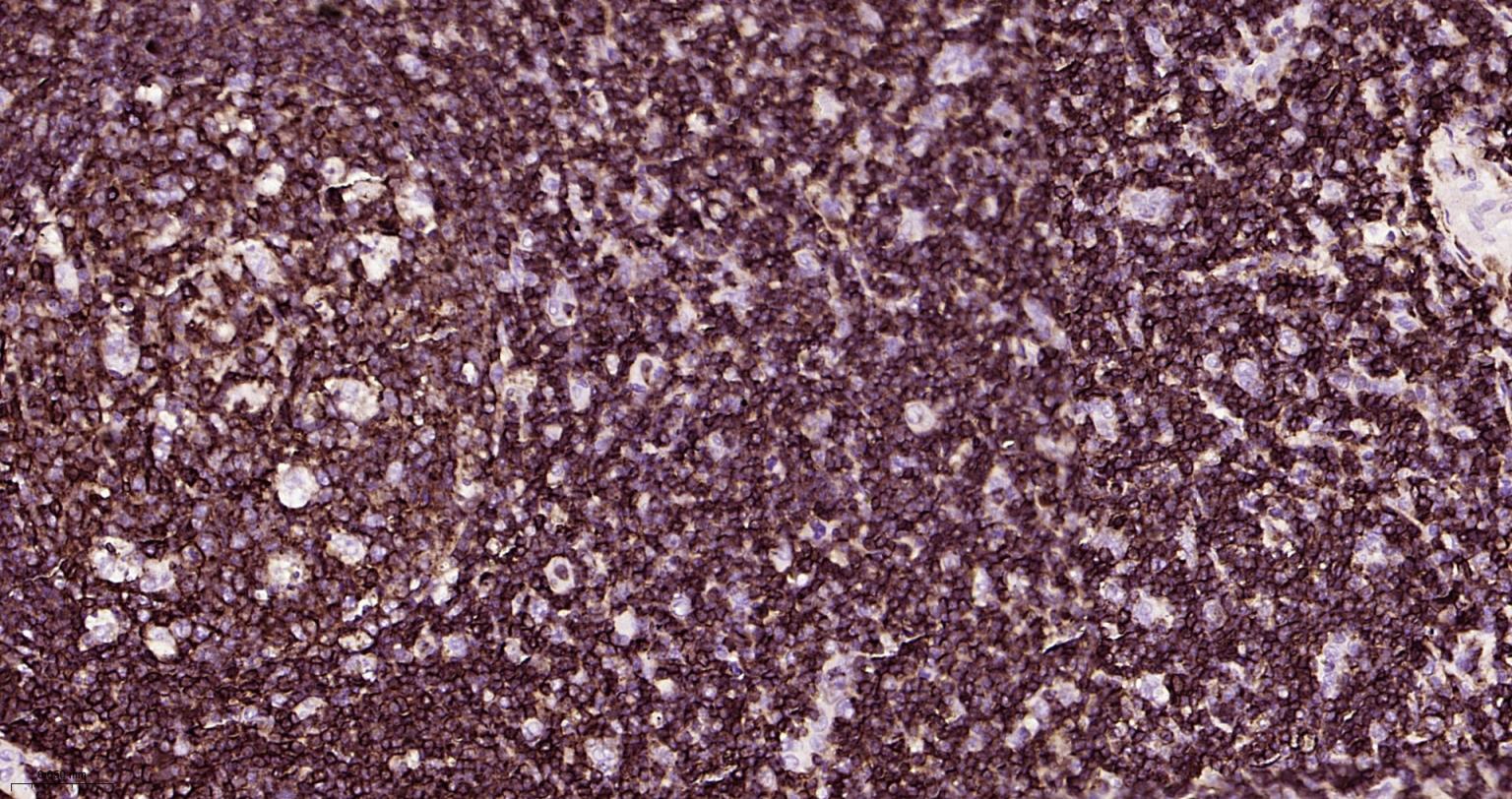 白细胞共同抗原CD45重组兔单抗-bsm-54757R