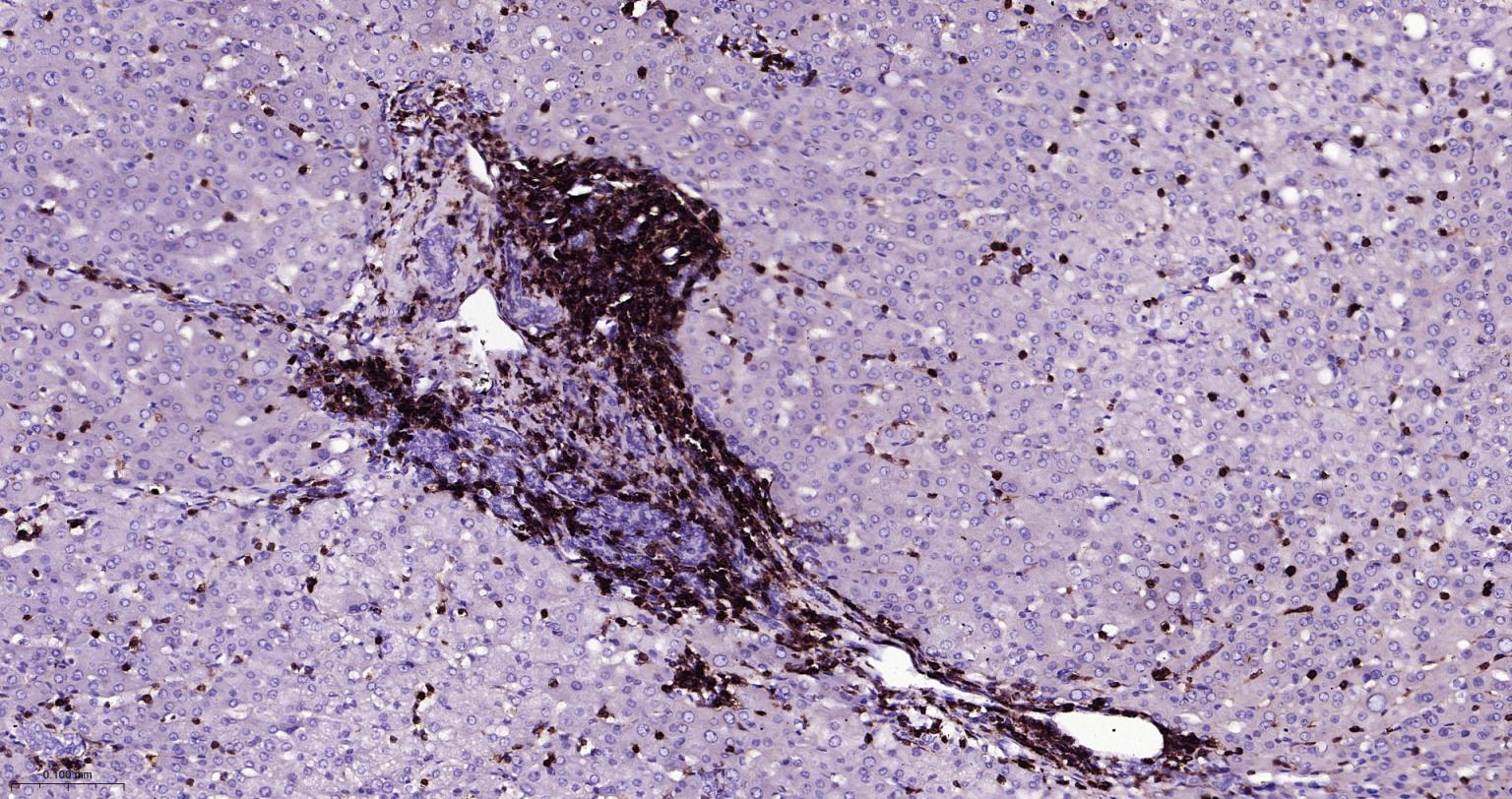 白细胞共同抗原CD45重组兔单抗-bsm-54757R