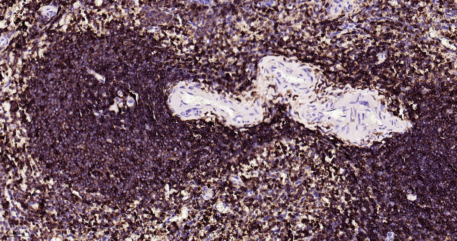 白细胞共同抗原CD45重组兔单抗-bsm-54757R