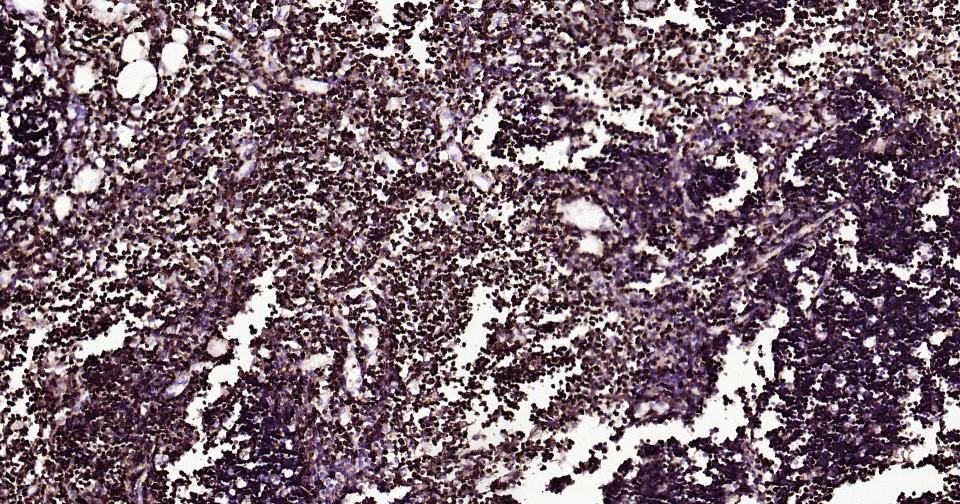 白细胞共同抗原CD45重组兔单抗-bsm-54757R
