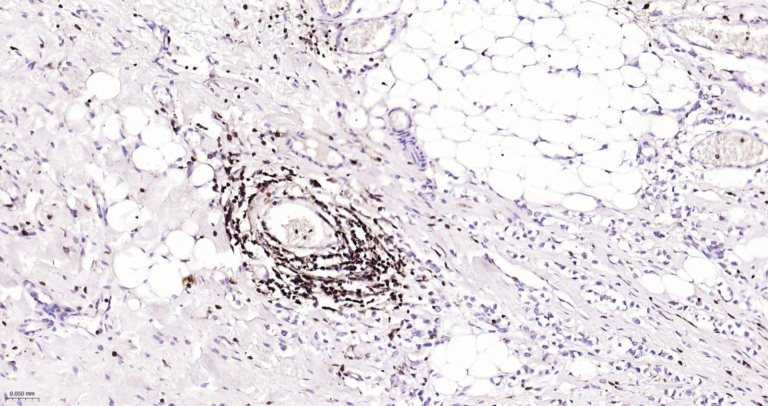 白细胞共同抗原CD45重组兔单抗-bsm-54757R