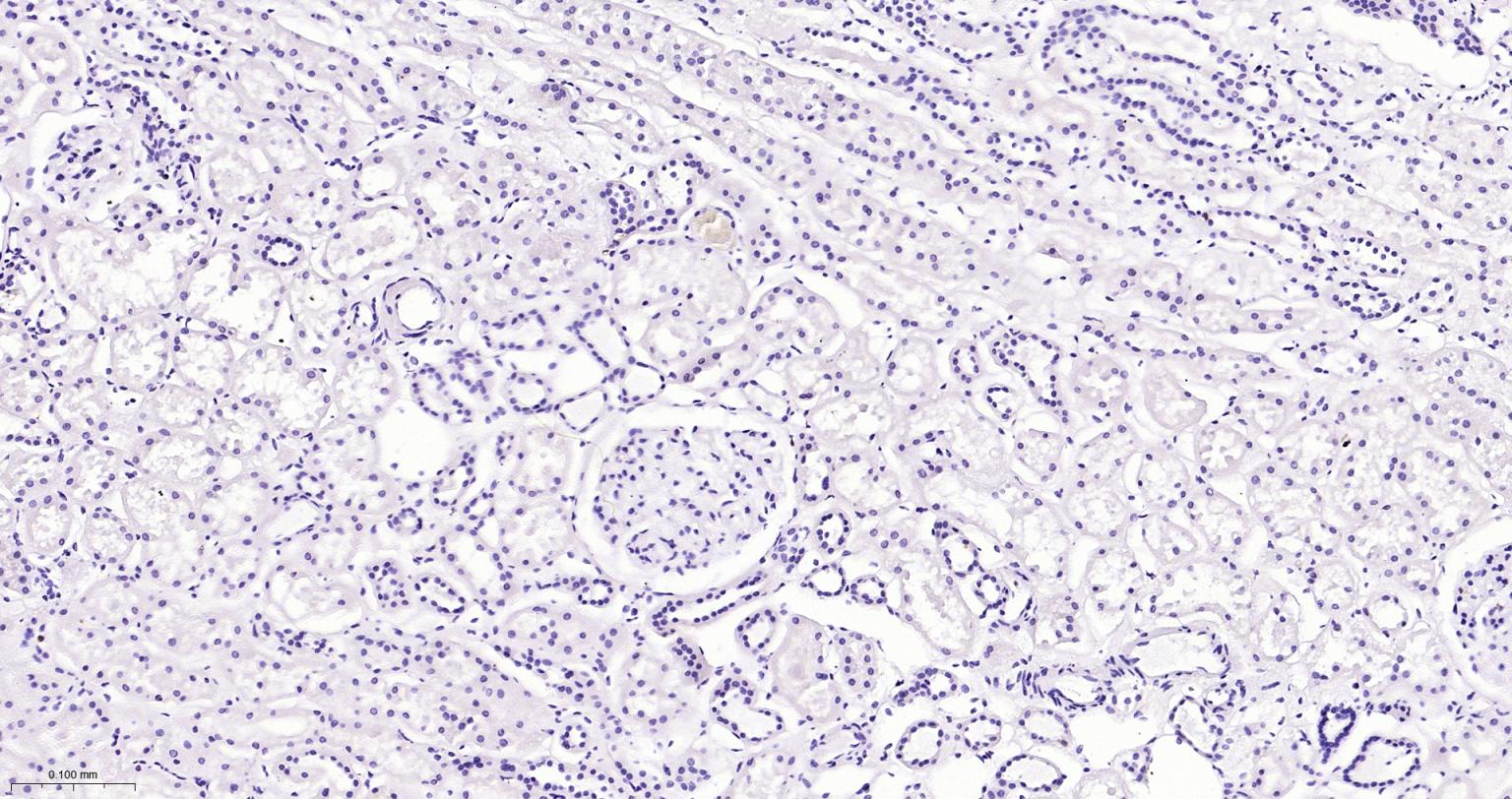 白细胞共同抗原CD45重组兔单抗-bsm-54757R