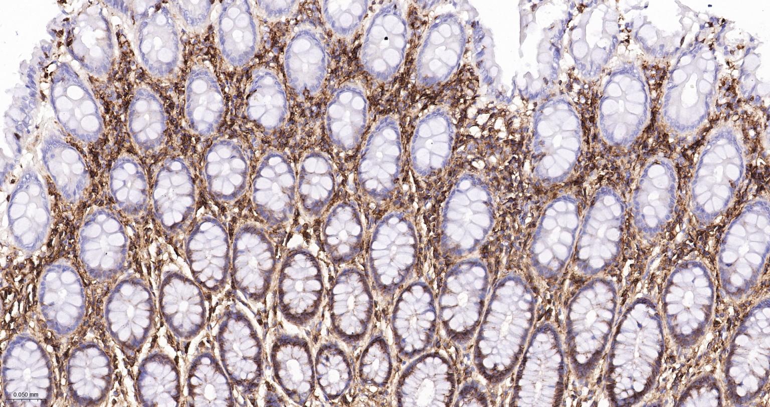 CD44重组兔单抗-bsm-54767R