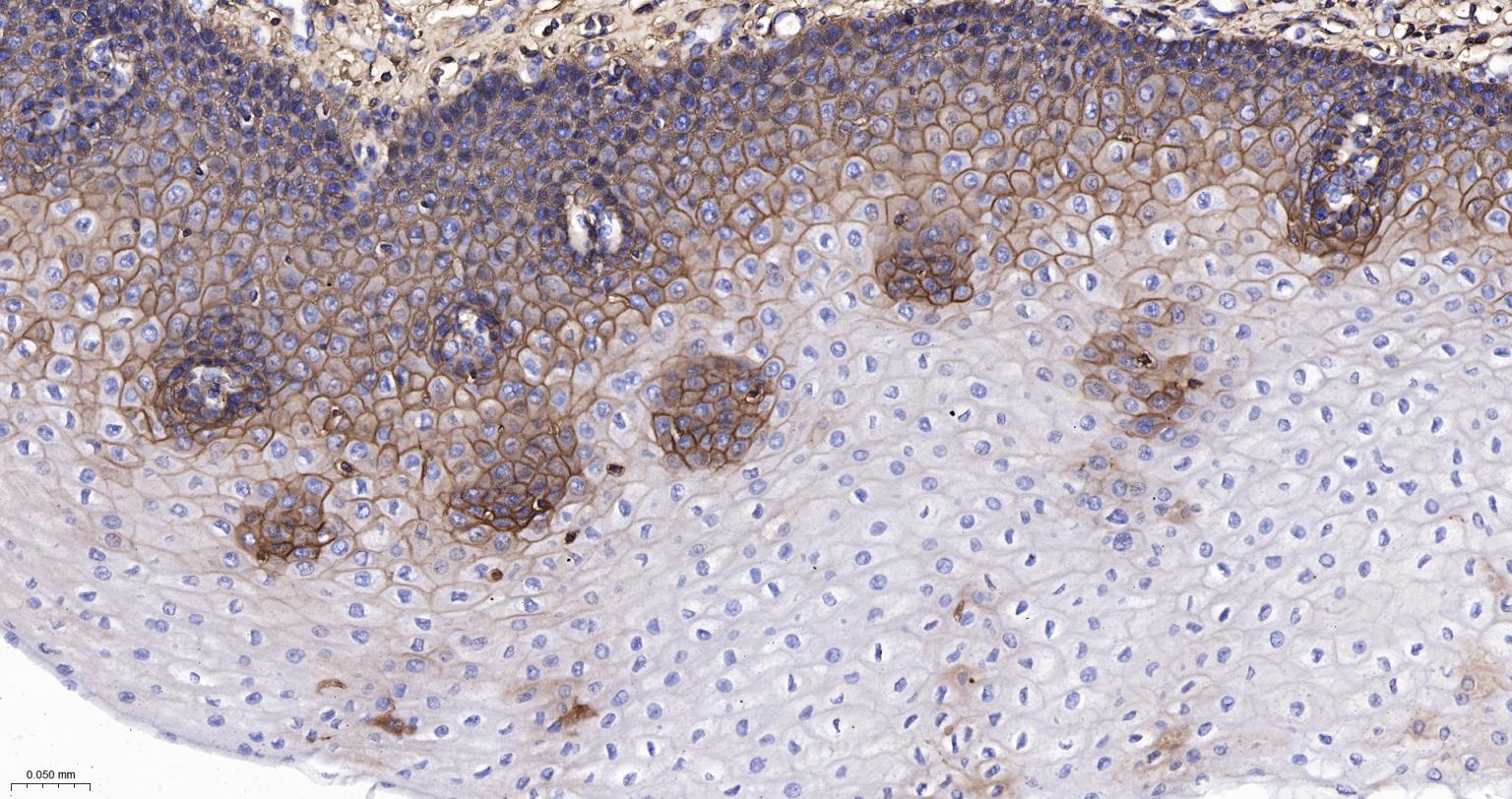 CD44重组兔单抗-bsm-54767R