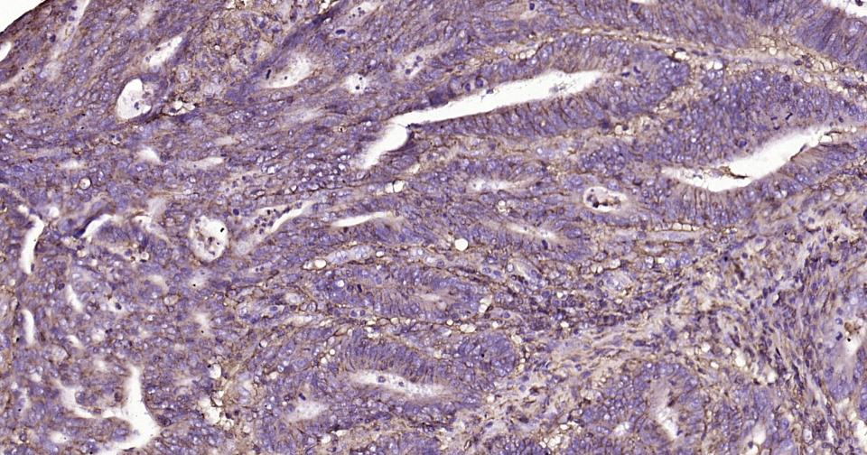 CD44重组兔单抗-bsm-54767R