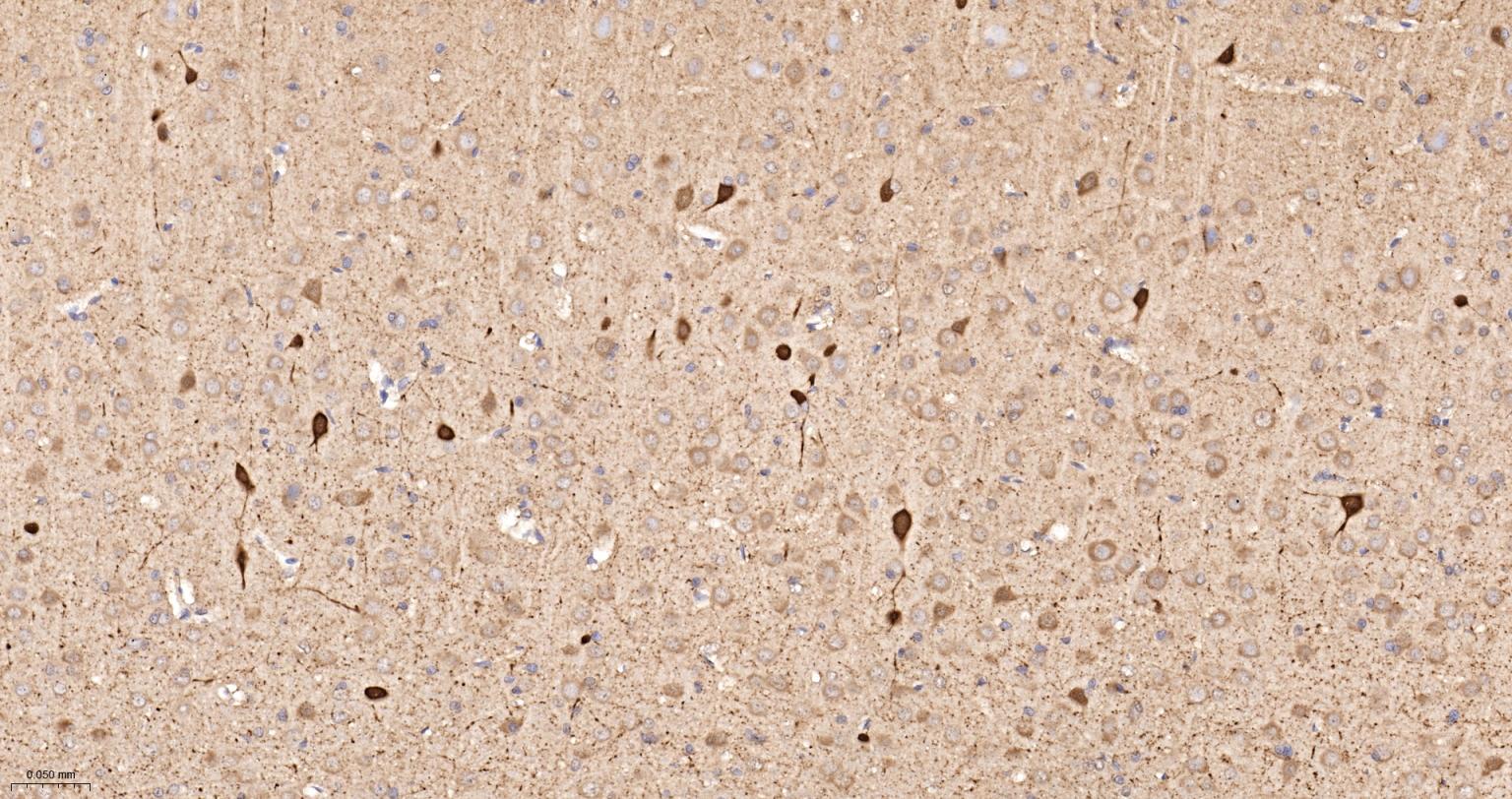 钙结合蛋白D28K重组兔单抗-bsm-60713R