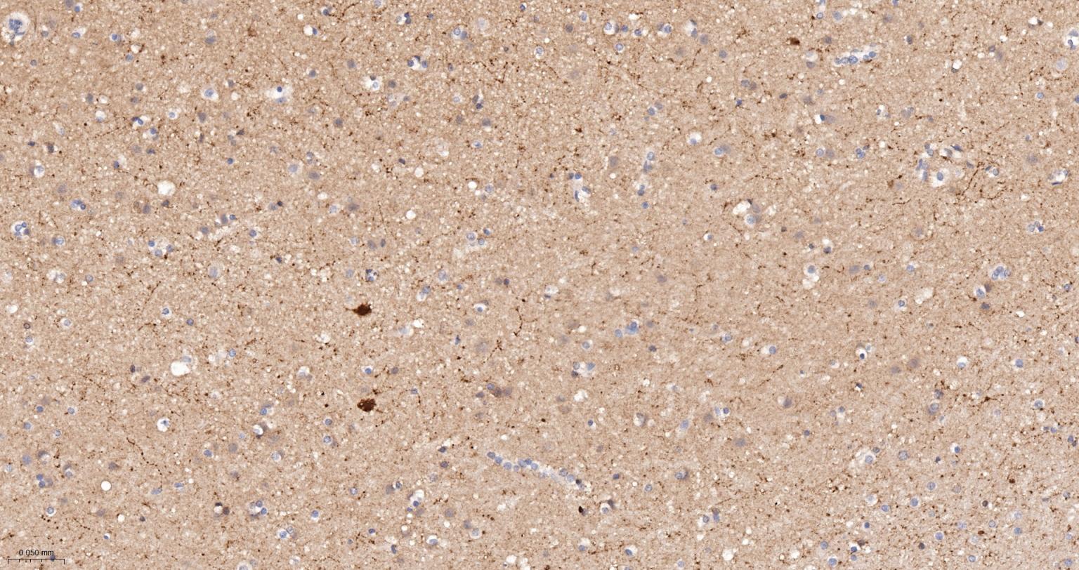 钙结合蛋白D28K重组兔单抗-bsm-60713R