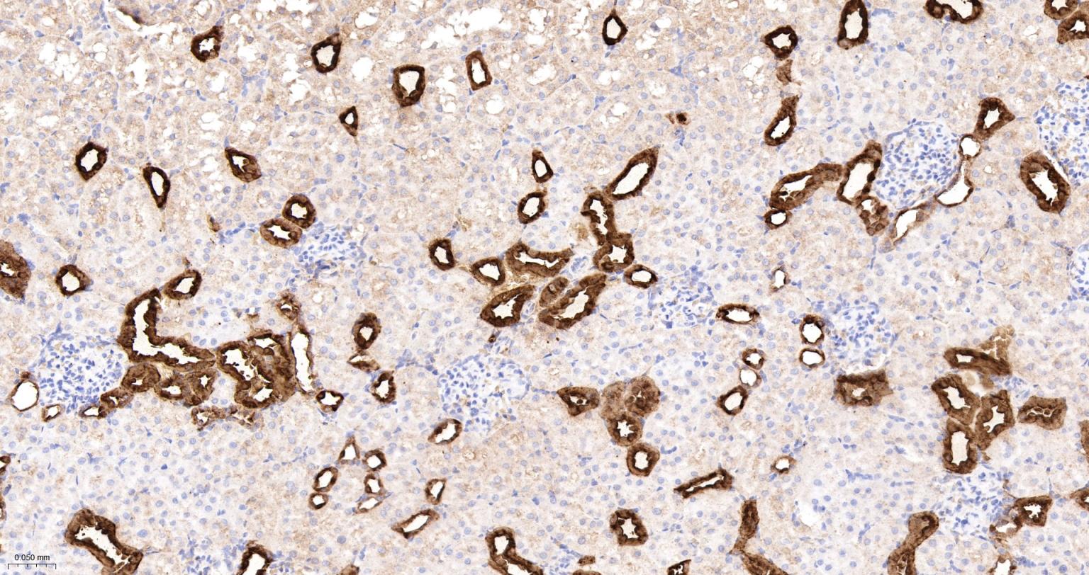 钙结合蛋白D28K重组兔单抗-bsm-60713R
