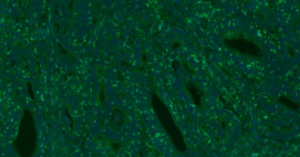 CD8重组兔单抗-bsm-61078R