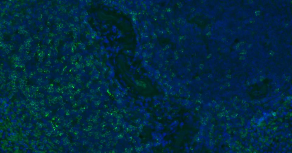 CD8重组兔单抗-bsm-61078R