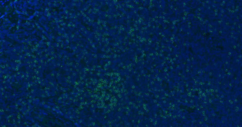 CD8重组兔单抗-bsm-61078R