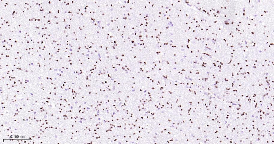 少突胶质细胞转录因子2重组兔单抗-bsm-61115R
